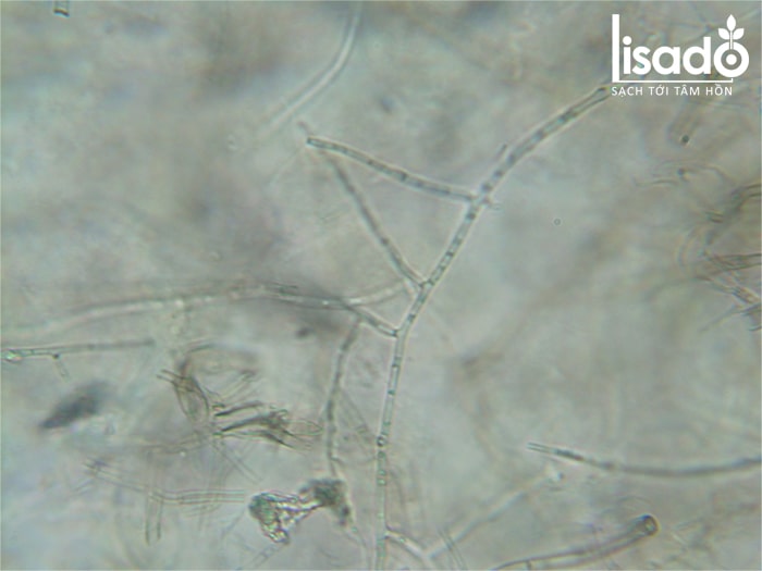 Fusarium solani là loại nấm gây ra bệnh thối thân trên cây dưa lưới